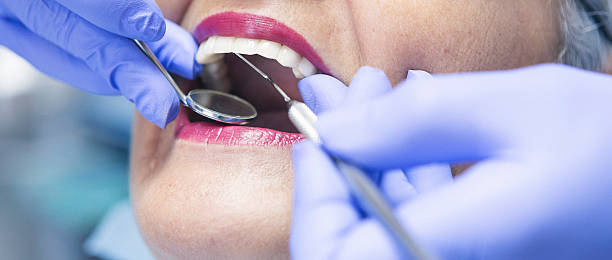 Best Emergency Tooth Extraction in Midway, UT